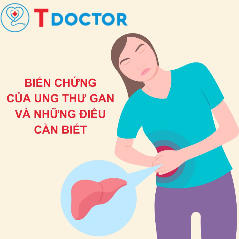 Biến chứng của ung thư gan - Những điều cần biết